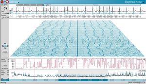 logiciel pour Holter cardiaque