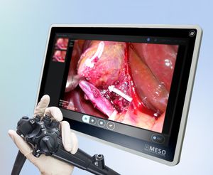 enregistreur vidéo avec conversion fichiers DICOM