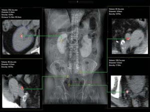 logiciel d'hôpital