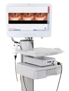 colonne d'endoscopie pour laryngoscopie