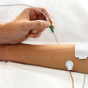 électrode EMG