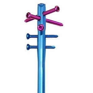 clou intramédullaire de tibia