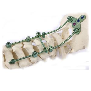 système d’ostéosynthèse occipito-cervical