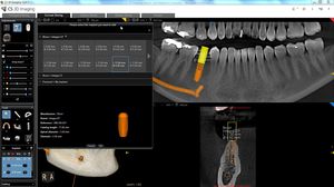 logiciel orthodontique