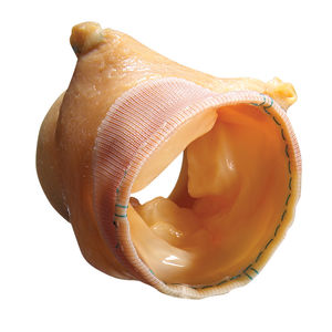 bioprothèse valvulaire aortique