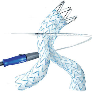 stent-greffe aorte abdominale