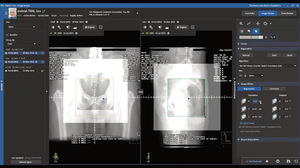 logiciel pour imagerie médicale