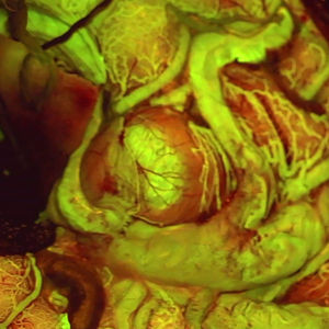 module de microscope à fluorescence