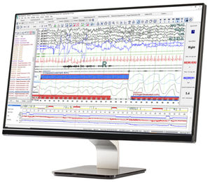logiciel d'analyse