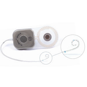 implant cochléaire partie interne