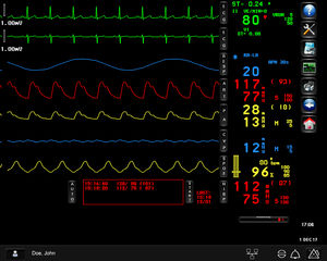 logiciel de monitorage