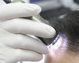 trichoscope vidéo