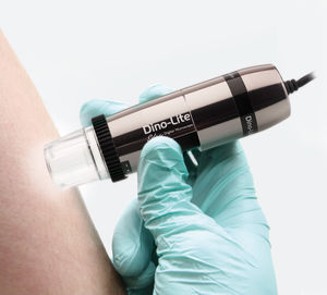 dermatoscope vidéo