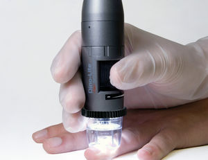 capillaroscope vidéo