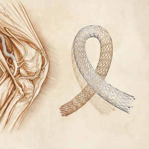 stent périphérique