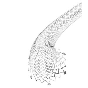 stent périphérique