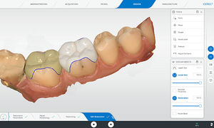 logiciel orthodontique