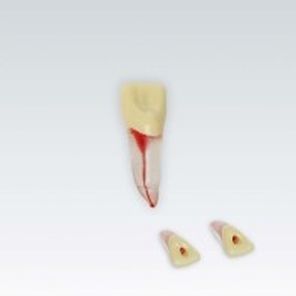 modèle anatomique de dents