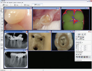 logiciel pour imagerie dentaire