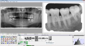 logiciel pour imagerie dentaire
