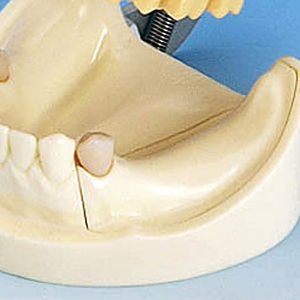 modèle anatomique de dentition