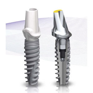 implant dentaire conique