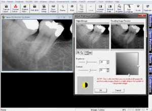 logiciel pour imagerie dentaire