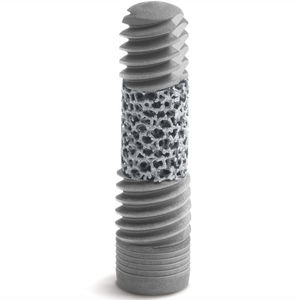 implant dentaire cylindrique