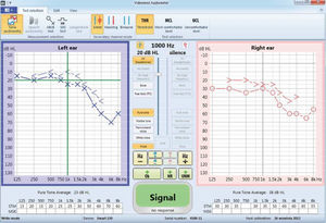 logiciel d'audiométrie