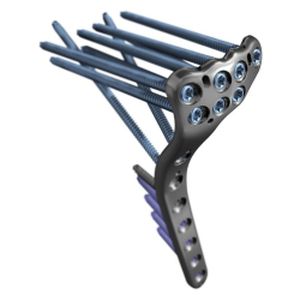 plaque de compression de tibia