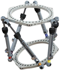 fixateur externe de tibia