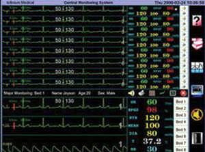 centrale de surveillance patient / 32 lits