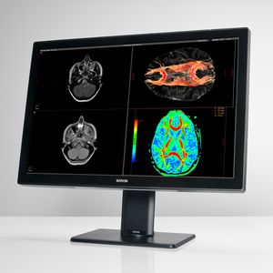 écran de diagnostic