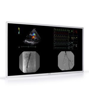 écran pour radiologie