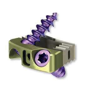 cage intersomatique cervicale