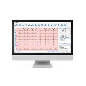 logiciel pour ECG