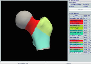 algorithme pour radiologie