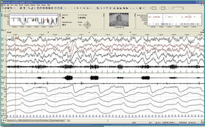 logiciel pour EEG