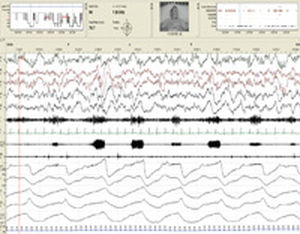 logiciel de gestion / d'analyse / de diagnostic / d'acquisition