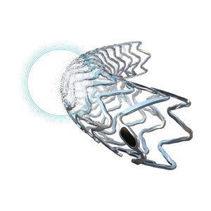 stent coronarien