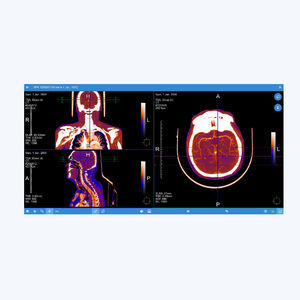 PACS pour imagerie médicale