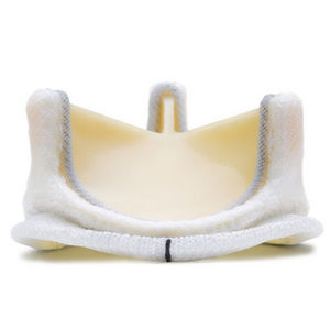 bioprothèse valvulaire aortique