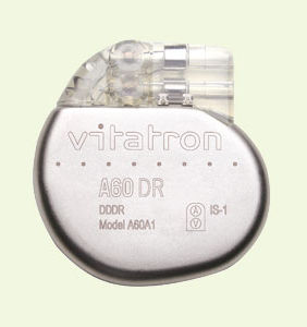 pacemaker
