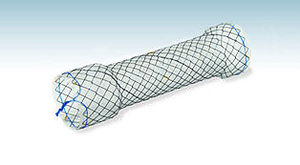 stent colorectal