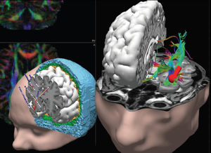 logiciel pour EEG