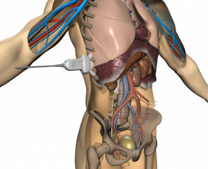 simulateur patient pour soins cliniques