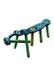 plaque de compression de tibia