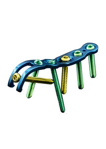 plaque de compression de tibia
