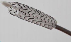 stent biliaire