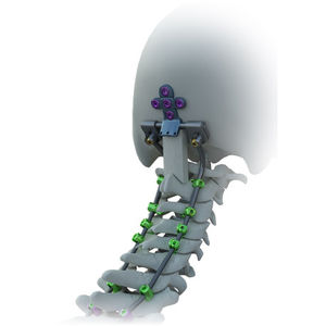 système d’ostéosynthèse occipito-cervical